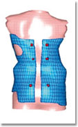 Simulation de corset avec la méthode MEF