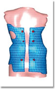 Korsettsimulation per MEF-Methode