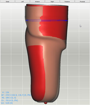 copy and move an anatomical area